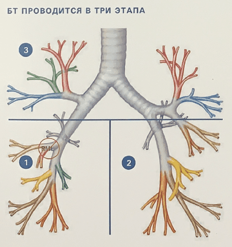 БТ ПРОВОДИТСЯ В ТРИ ЭТАПА