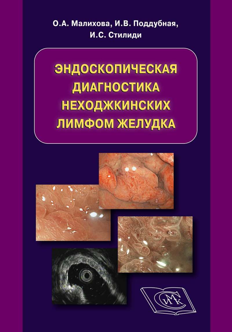 Malihova_Endo_diagnostica_nehodjkinskih_Limfoma_EndoExpert.ru.jpg Malihova_Endo_diagnostica_nehodjkinskih_Limfoma_EndoExpert.ru.jpg