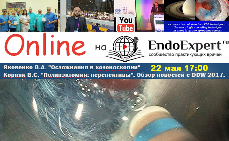 онлайн Вебинар Яковенко В 17 00.png