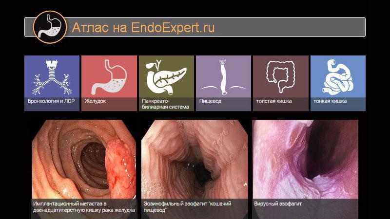 Атлас новый раздел на портале EndoExpert.ru