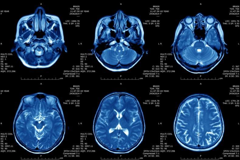 мрт снимок мрт снимок