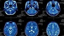 Росстандарт утвердил четыре национальных стандарта по профилю «Системы искусственного интеллекта в клинической медицине»