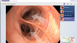 BronchoGuide App от Olympus - Приложение для изучения анатомии Бронхиального дерева
