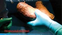 EndoExpert дайджест Эндоскопии 4 номер. Интернет журнал. EndoExpert Digest Endoscopy