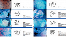 Poster PitPattern Fujinon