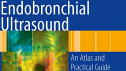 Endobronchial Ultrasound - An Atlas And Practical Guide 1st ed 2009 Ernst Herth