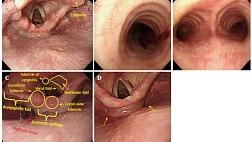 Технические навыки и обучение эндоскопии верхних отделов желудочно-кишечного тракта для новичков. Перевод С.М.Тергеусизов