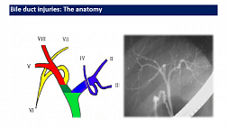 МНОГОСЛОЙНАЯ ТКАНЕИНЖЕНЕРНАЯ КОНСТРУКЦИЯ НА ОСНОВЕ БИОДЕГРАДИРУЕМЫХ И БИОСОВМЕСТИМЫХ МАТЕРИАЛОВ ДЛЯ ВОССТАНОВЛЕНИЯ ПОВРЕЖДЕННЫХ ЖЕЛЧНЫХ ПУТЕЙ Клабуков Илья Дмитриевич