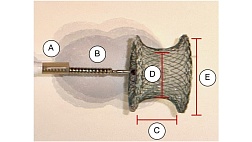 Эндоскопическое закрытие свищей пищевода, желудка, тонкой кишки и ректотазовой области с помощью окклюдеров перегородки сердца: серия случаев