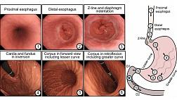 Показатели качества в диагностической эндоскопии верхних отделов желудочно-кишечного тракта