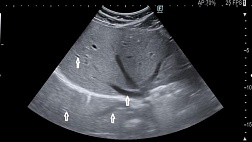 Что такое ультразвук?