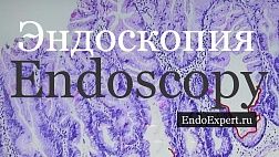 Проект EndoExpert.ru пришел в соц.сеть для врачей Доктор на работе