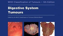 Классификация опухолей желудочно-кишечного тракта ВОЗ 2019, пятое издание.