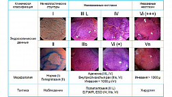 Современные классификации в эндоскопии