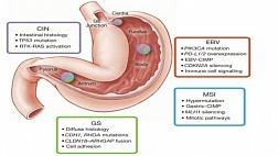 Молекулярно-генетическая классификация рака желудка и ее клиническое значение