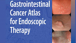 Gastrointestinal Cancer Atlas For Endoscopic Therapy Mar 2009