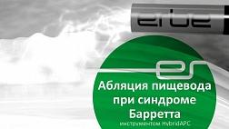 Абляция пищевода при синдроме Барретта инструментом HybridAPC