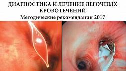 ДИАГНОСТИКА И ЛЕЧЕНИЕ ЛЕГОЧНЫХ КРОВОТЕЧЕНИЙ. Методические рекомендации № 25  2017г