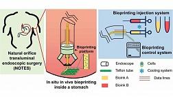 Технологии будущего, уже сегодня: 3D печать живыми клетками изнутри желудка. Биопринтер-Эндоскоп.
