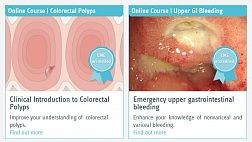 Онлайн курсы по эндоскопии и гастроэнтерологии