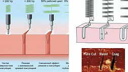 ОПЕРАТИВНАЯ ЭНДОСКОПИЯ, ХИРУРГИЧЕСКИЕ ЭНЕРГИИ: ЭЛЕКТРОКОАГУЛЯЦИЯ, АРГОНОПЛАЗМЕННАЯ КОАГУЛЯЦИЯ. РАДИОВОЛНОВАЯ ХИРУРГИЯ, ЭНДОКЛИПИРОВАНИЕ С.В.Давыдова А.Г.Федоров