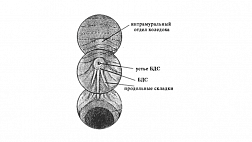 Диагностическая РХПГ. Техника выполнения (Рыжков Е.Ф.)