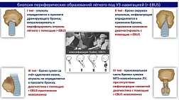 Классификация Tsuboi 1967г.