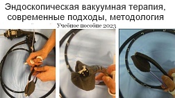 Учебное пособие "Эндоскопическая вакуумная терапия, современные подходы, методология"