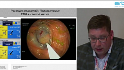 Материалы Конференции «Актуальные вопросы эндоскопии» Санкт-Петербург 2018 Обучающая зона "ЭЛЕКТРОХИРУРГИЯ"
