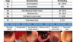 Классификация язвенных кровотечений по Forrest Форрест (1974)