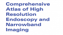 Comprehensive Atlas of High Resolution Endoscopy and Narrowband Imaging