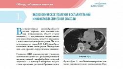 ЭНДОСКОПИЧЕСКОЕ УДАЛЕНИЕ  ВОСПАЛИТЕЛЬНОЙ МИОФИБРОБЛАСТИЧЕСКОЙ ОПУХОЛИ