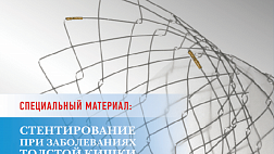 EndoExpert дайджест Эндоскопии 6 номер. Интернет журнал. EndoExpert Digest Endoscopy