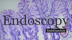 Проект EndoExpert.ru пришел и в VK