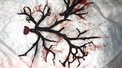 ЛЕЧЕБНО-ДИАГНОСТИЧЕСКИЙ АЛГОРИТМ ПРИ ЛЕГОЧНЫХ КРОВОТЕЧЕНИЯХ