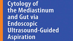 Cytology of the Mediastinum and Gut Via Endoscopic Ultrasound - Guided Aspiration - Springer International Publishing 2015