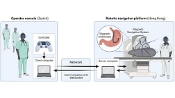 Впервые в мире выполнена дистанционно управляемая эндоскопическая операция с использованием магнитной навигационной системы