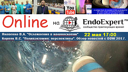 Материалы Вебинара "Осложнения в эндоскопии" Яковенко В.А. "Полипэктомия: перспективы" Корпяк В.С. Обзор новостей c DDW 2017.