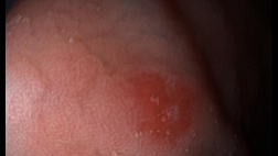 Клинический случай МегаМарофон  2025 