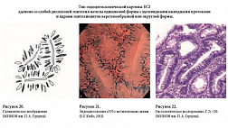 ЭНДОЦИТОСКОПИЯ - НОВЫЙ МЕТОД ЭНДОСКОПИЧЕСКОГО ИССЛЕДОВАНИЯ: ОСНОВЫ И АЛГОРИТМ ВЫПОЛНЕНИЯ