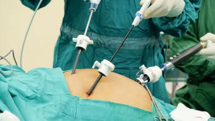 Эндоскопия паховой грыжи