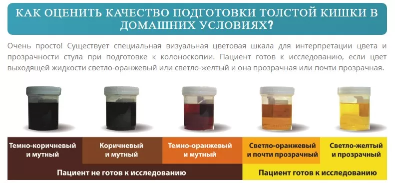 Подготовка к колоноскопии в домашних условиях