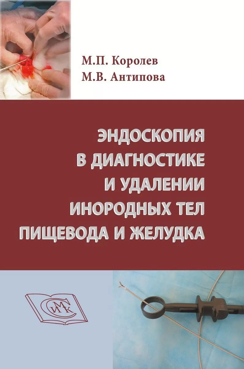Эндоскопия в диагностике и удалении инородных тел пищевода и желудка, СИМК, 2022