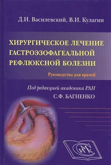 Хирургическое лечение гастроэзофагеальной рефлюксной болезни.