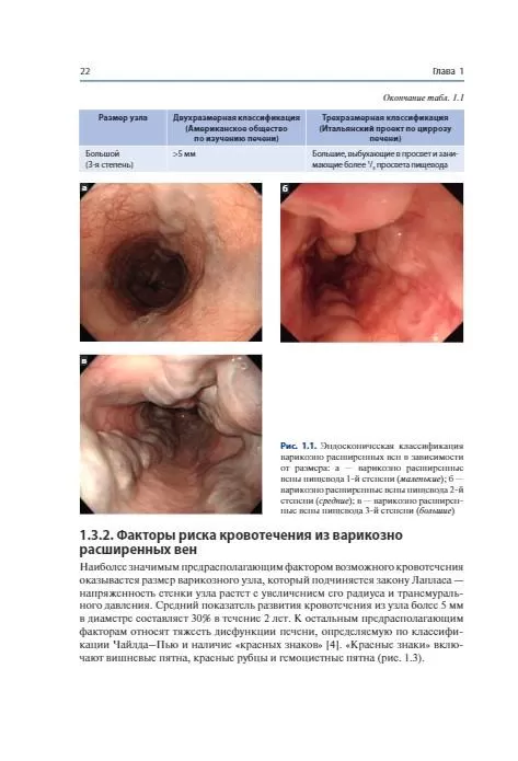 Терапевтическая эндоскопия желудочно-кишечного тракта. Атлас. Х.Дж. Чун, С.К. Янг, М.Г. Чой