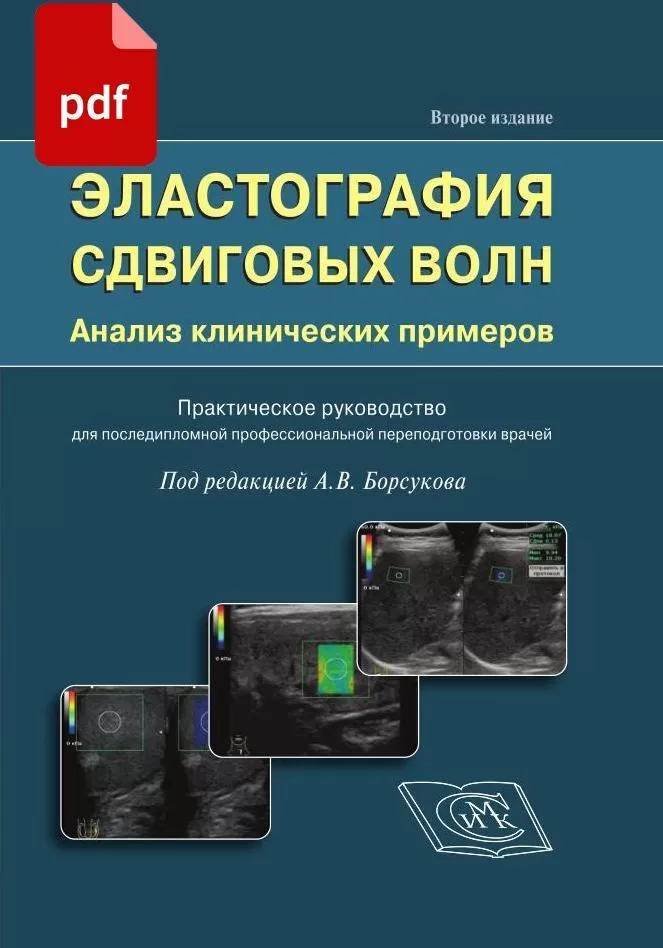 Электронная книга PDF версия. Эластография сдвиговых волн. Анализ клинических примеров практическое руководство для врачей. СИМК.