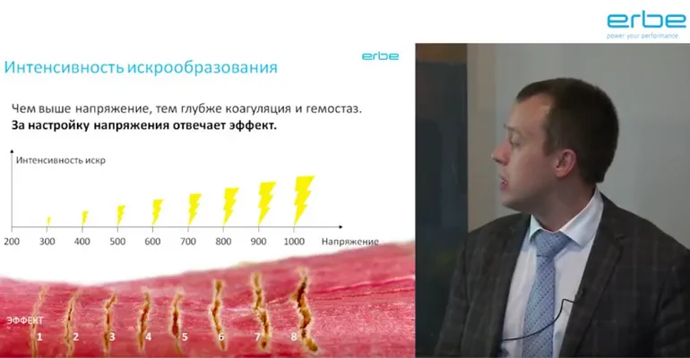 ErbeEndoExpertAVE18.png ErbeEndoExpertAVE18.png