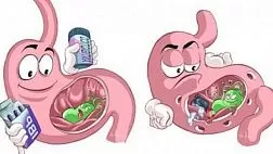 Показания для гастроскопии ЭГДС