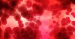 Ведение невариксного кровотечения из верхних отделов желудочно-кишечного тракта: руководящие рекомендации Международной консенсусной группы 2019 (Перевод последнего гайдлайна по кровотечениям)