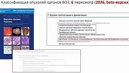 WHO 2026 обновила классификацию опухолей толстой и прямой кишки